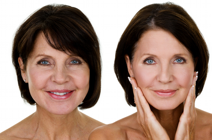 anti-aging-treatment-image