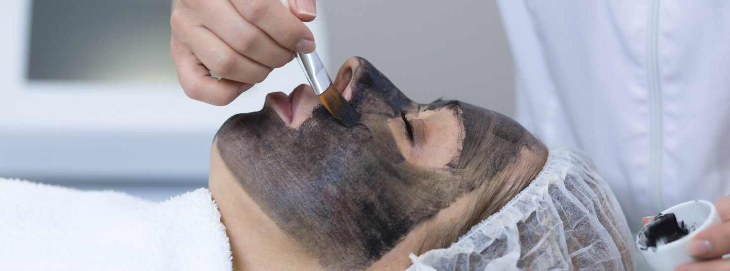 Surrey Carbon Peel | Professional Skin Facial | Treat Acne, Aging + More