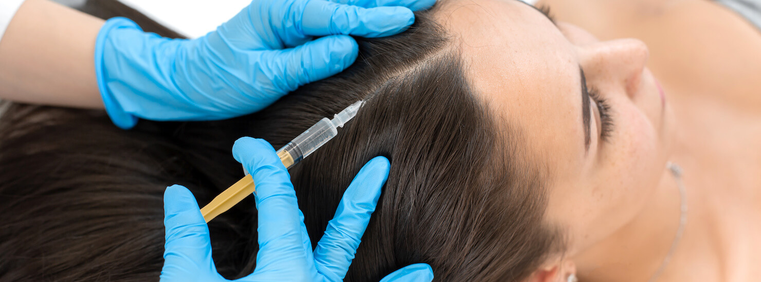 Can You Use a 32-Gauge Needle for PRP Hair Loss Treatment? - Face Med Store