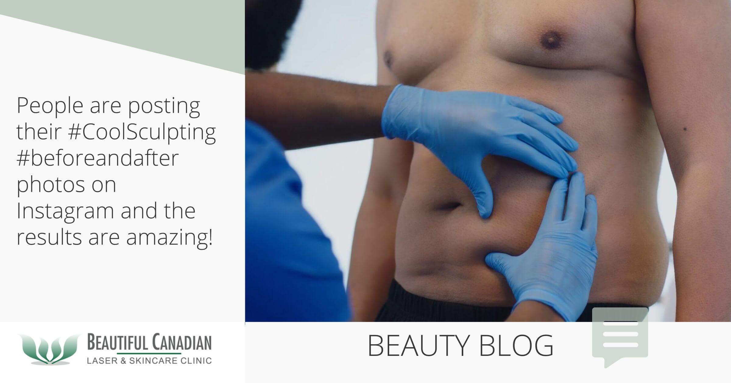 Transformation of the Week: Tone and Taut Tummy With CoolSculpting - The  Body Squad