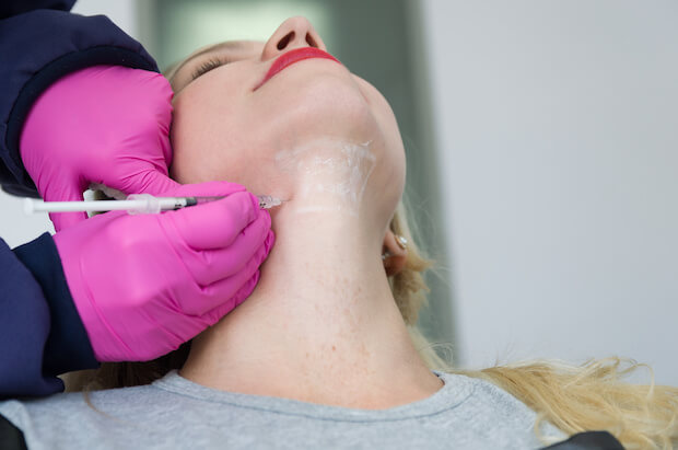 fat chin submental injection rid belkyra injections removal dissolve fullness under surrey vancouver does